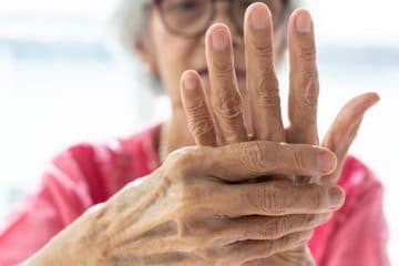 Essential Oils for Arthritis