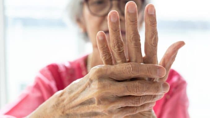 Essential Oils for Arthritis