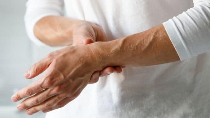 What You Need to Know About Rheumatoid Arthritis