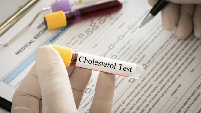 cholesterol-test