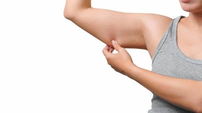 Banishing Bat Wings – 7 Amazing Exercises to Reduce Arm Fat