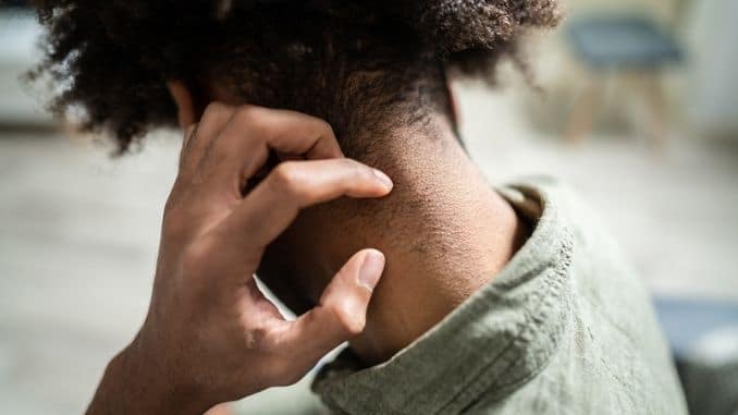 man-scratching-his-neck