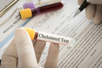 Tips for High Cholesterol